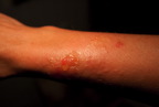 TalaThumb0228.jpg